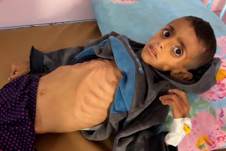 Hunger Continues to Claim Lives in Gaza