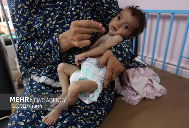 Death Toll from Famine and Malnutrition in Gaza Rises to 197