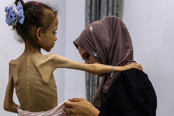West and Hunger in Gaza: When the Complicit Caregiver Becomes a Victim